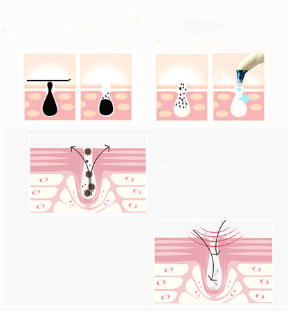 Electric Blackheads Remover Blackheads Artifact Household Pore Cleaner Microcrystalline Beauty Apparatus